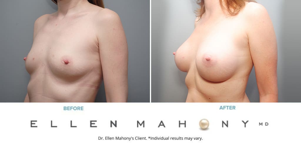 Before and After Image: Case #10067 - left-front-oblique