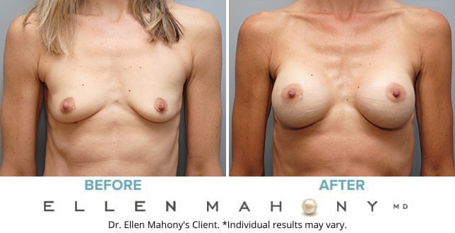 Before and After Image: Case #9698 - front