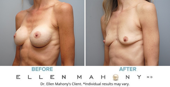 Before and After Image: Case #9698 - left-front-oblique