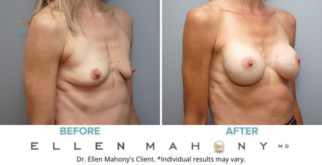 Before and After Image: Case #9698 - right-front-oblique