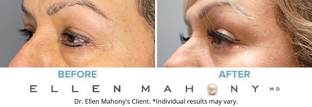 Before and After Image: Case #9583 - left-front-oblique