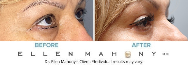Before and After Image: Case #9583 - right-front-oblique