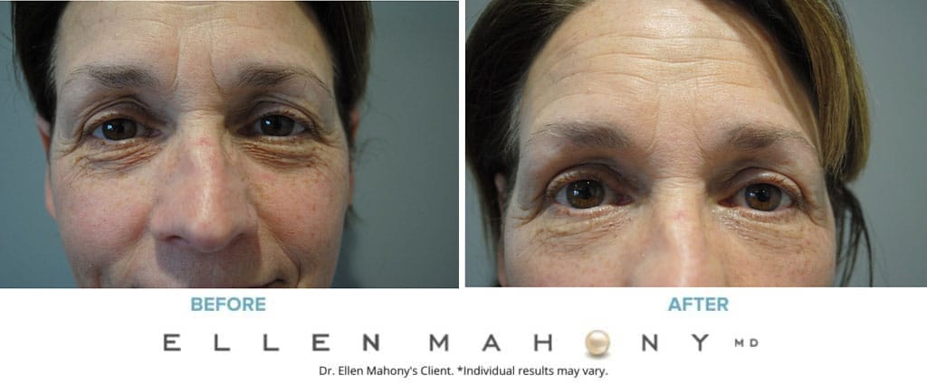 Before and After Image: Case #8850 - front