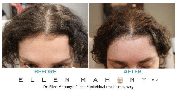Before and After Image: Case #13477 - front