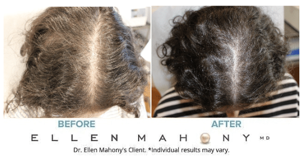 Before and After Image: Case #13477 - front