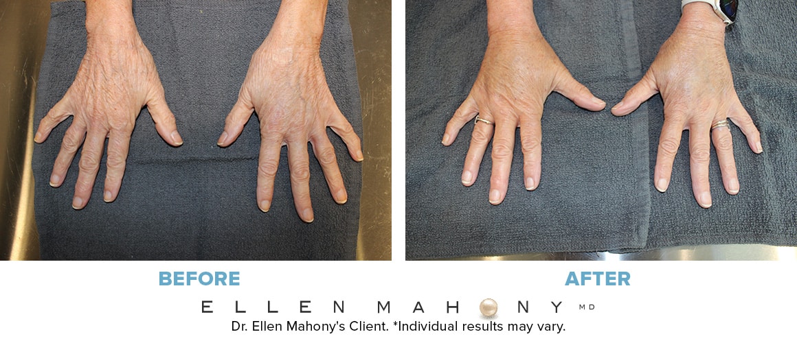 Before and After Image: Case #13212 - front