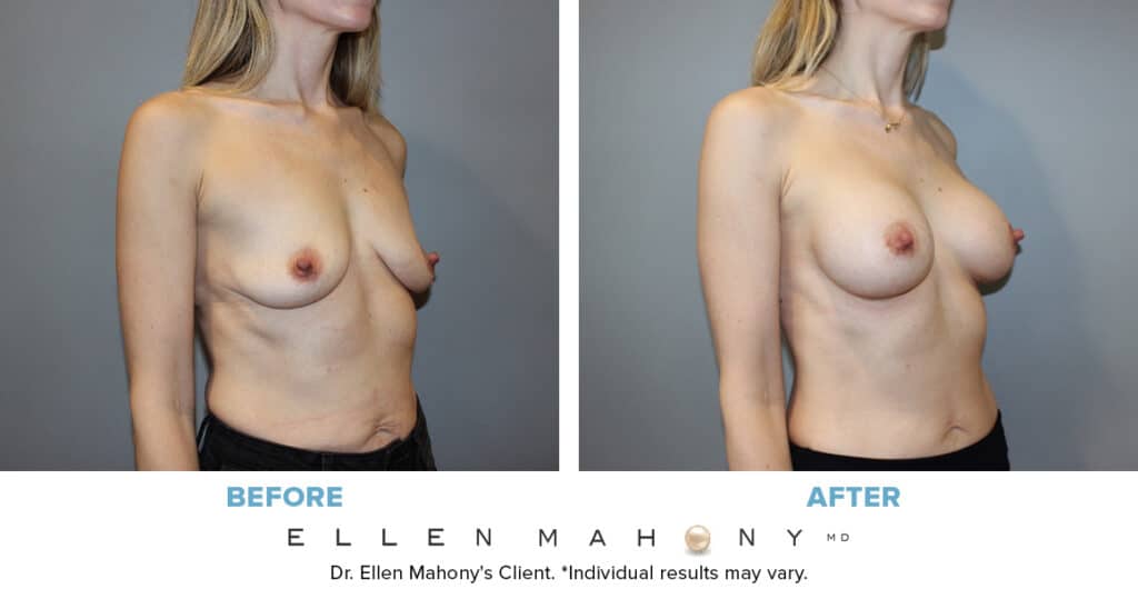 Before and After Image: Case #13048 - right-front-oblique