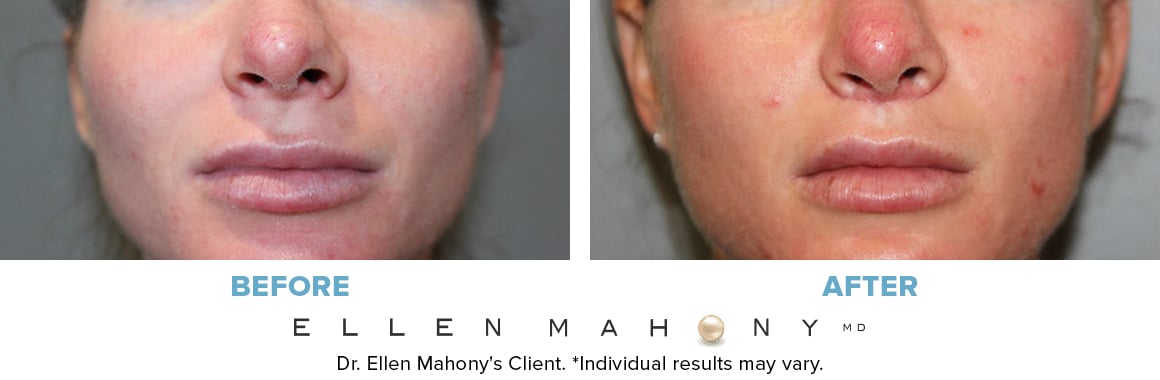 Before and After Image: Case #13521 - front