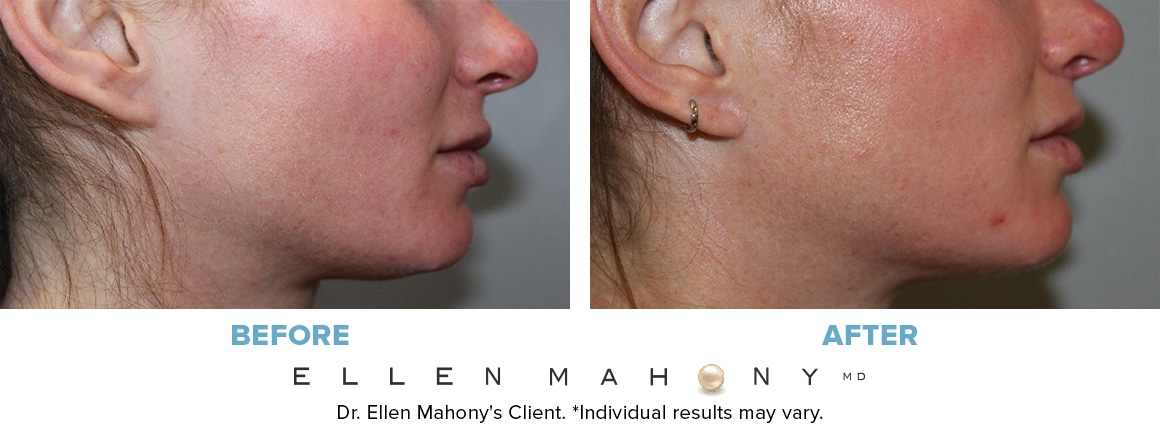 Before and After Image: Case #13521 - right-side