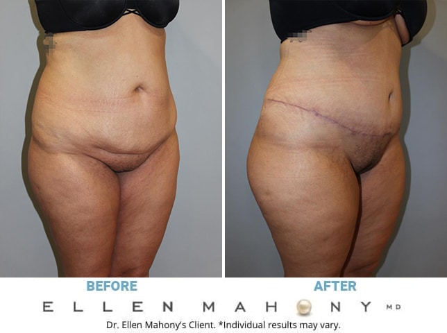 Before and After Image: Case #12591 - right-front-oblique