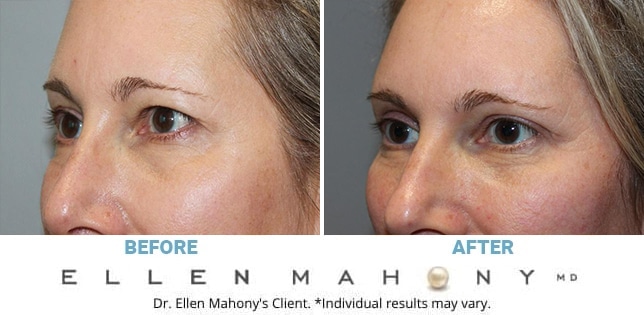 Before and After Image: Case #12814 - left-front-oblique