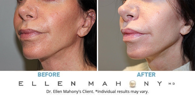 Before and After Image: Case #12850 - left-front-oblique
