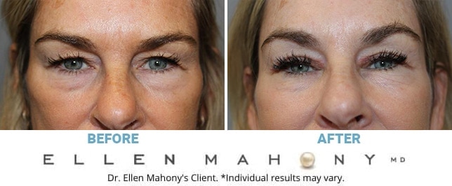 Before and After Image: Case #10050 - front
