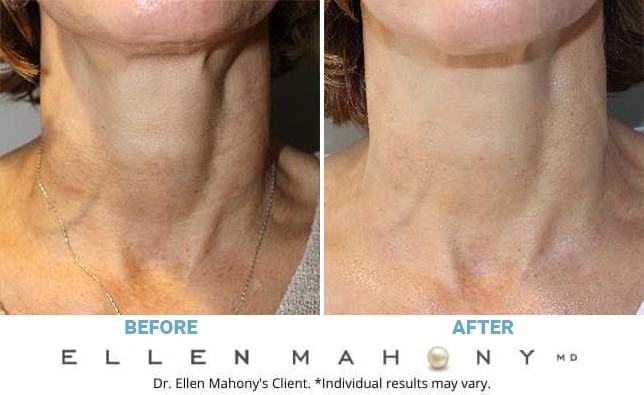 Before and After Image: Case #12220 - front