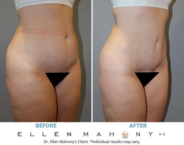 Before and After Image: Case #12963 - right-front-oblique