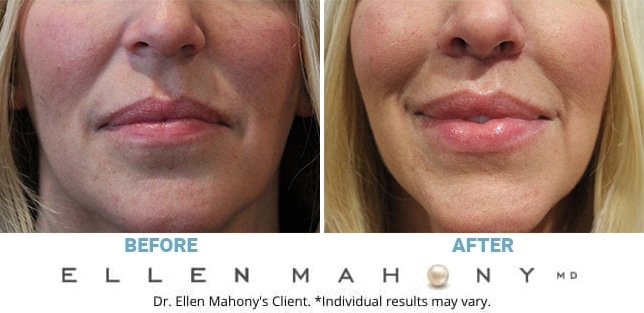 Before and After Image: Case #12218 - front