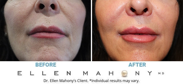 Before and After Image: Case #12470 - front
