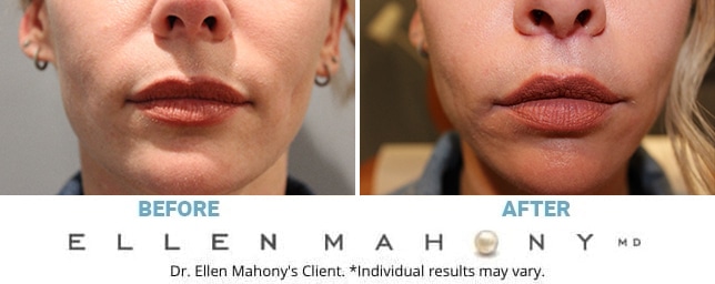 Before and After Image: Case #12859 - front