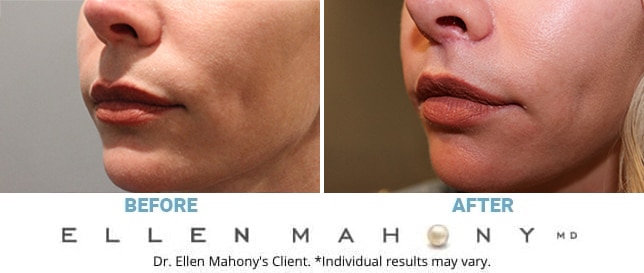 Before and After Image: Case #12859 - left-front-oblique