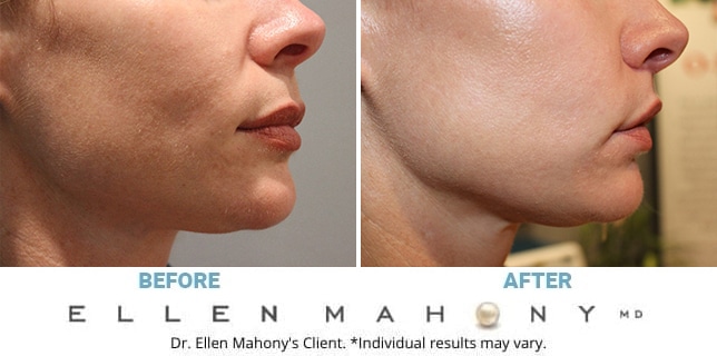 Before and After Image: Case #12859 - right-side
