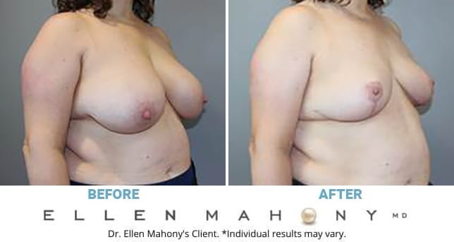 Before and After Image: Case #13277 - right-front-oblique