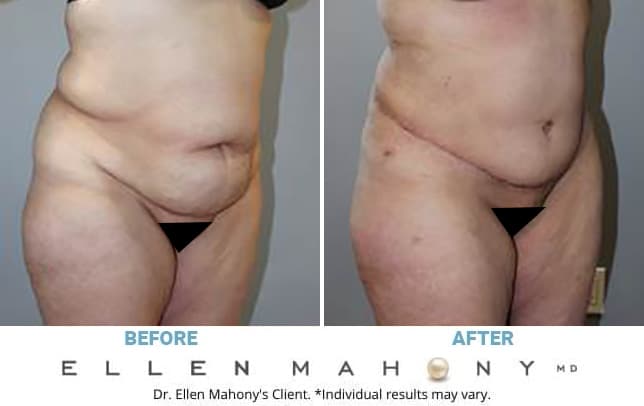 Before and After Image: Case #13396 - right-front-oblique