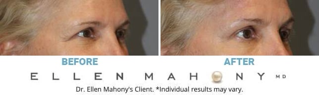 Before and After Image: Case #13739 - right-front-oblique