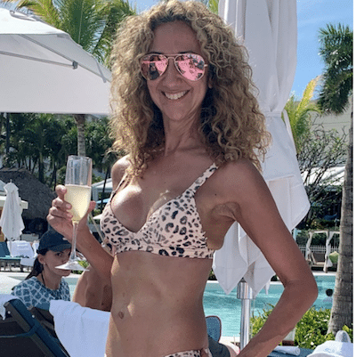 Breast Augmentation in Westport, CT
