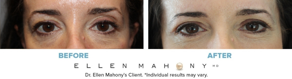 Before and After Image: Case #12796 - front
