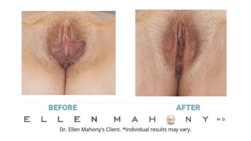 Before and After Image: Case #15162 - front