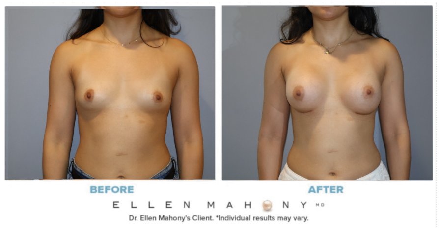 Before and After Image: Case #15157 - front
