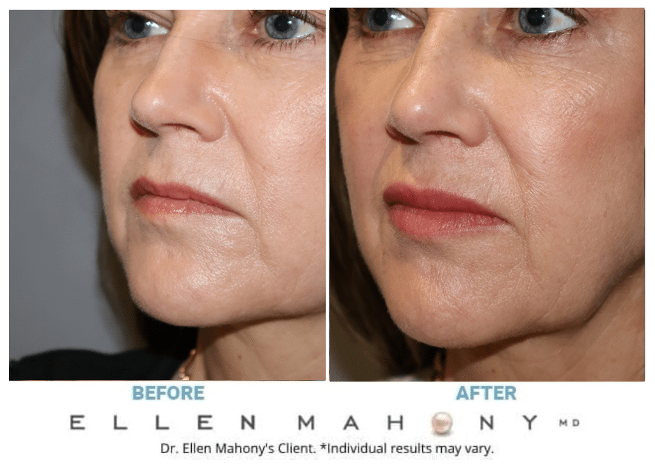 Before and After Image: Case #11899 - left-front-oblique