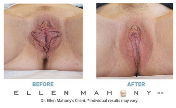 Before and After Image: Case #15267 - front