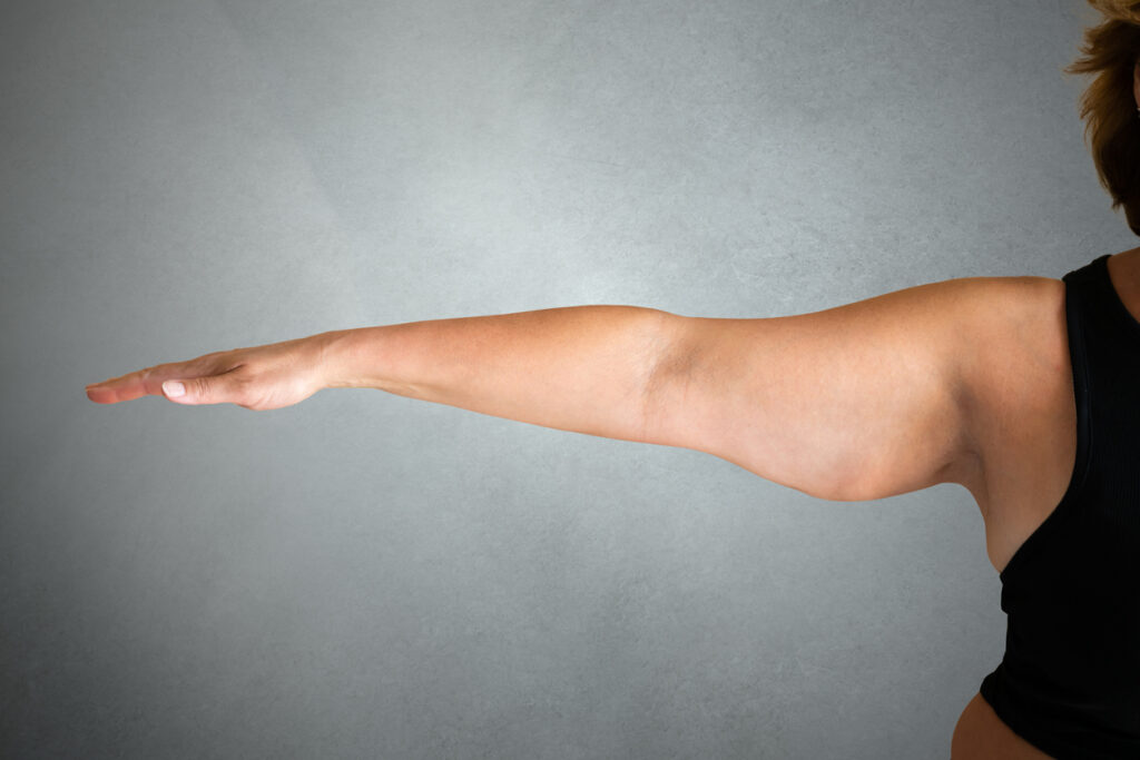 Woman holding out her arm showing loose skin